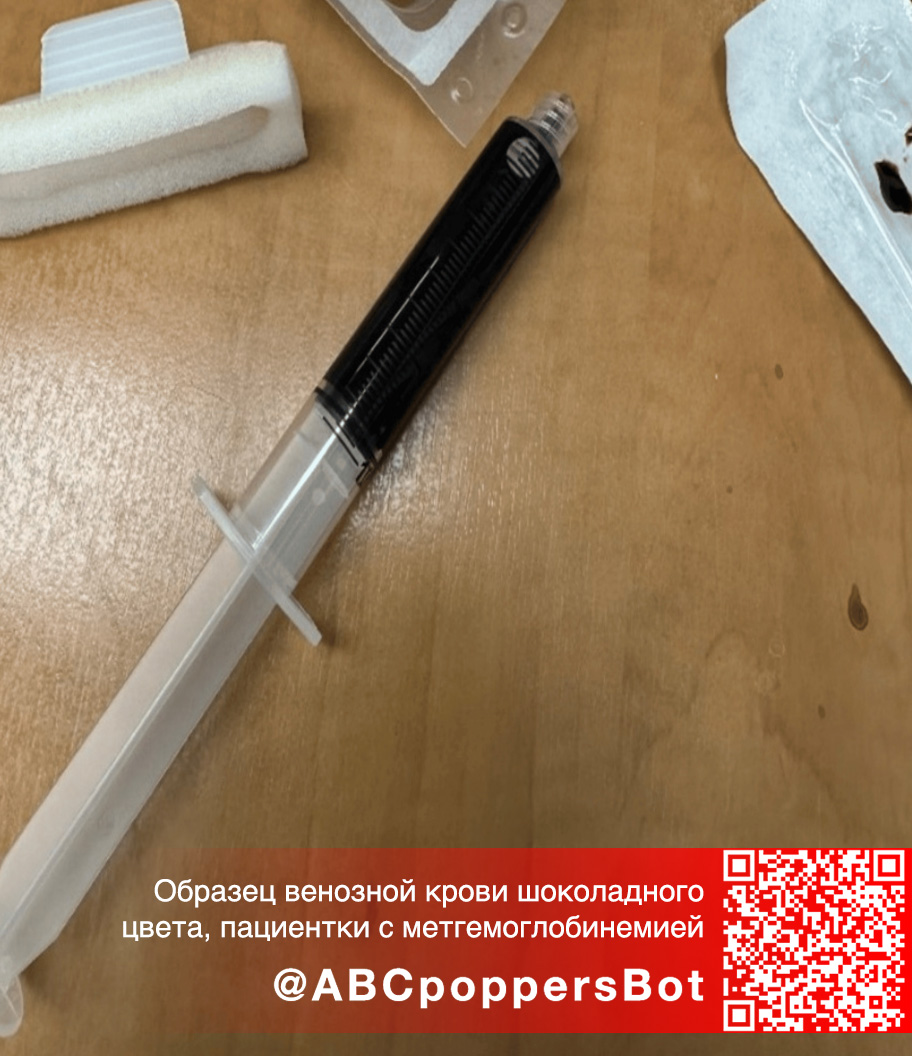 Если принять попперс внутрь в Шахтах это вызывает метгемоглобинемию. Смертельное состояние Если принять попперс внутрь в Шахтах это вызывает метгемоглобинемию. Смертельное состояние